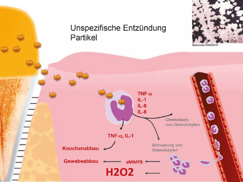 unspezifische entzündungen